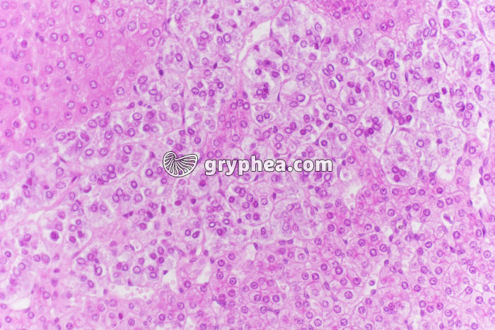 Surrénale - Capsule surrénale (zones réticulée et médullaire) x100 - gryphea.com